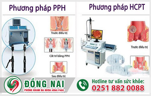 Chi phí cắt trĩ tốn bao nhiêu tiền?