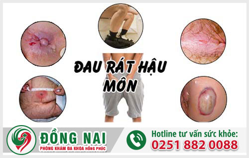 Ảnh hưởng của bệnh trĩ đối với người bệnh