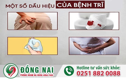  Một số dấu hiệu bệnh trĩ điển hình