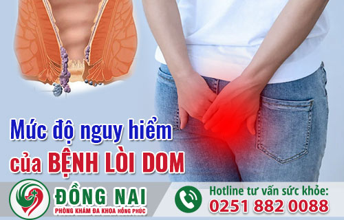 Mức độ nguy hiểm của bệnh lòi dom