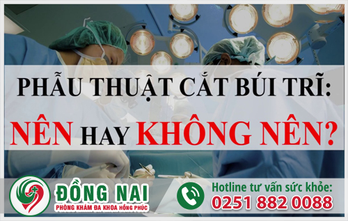 Có nên phẫu thuật cắt trĩ không?