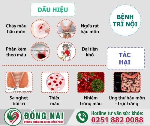 Cách chữa trị bệnh trĩ nội hiệu quả nhanh hồi phục