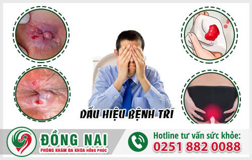 Dấu hiệu nhận biết bệnh trĩ