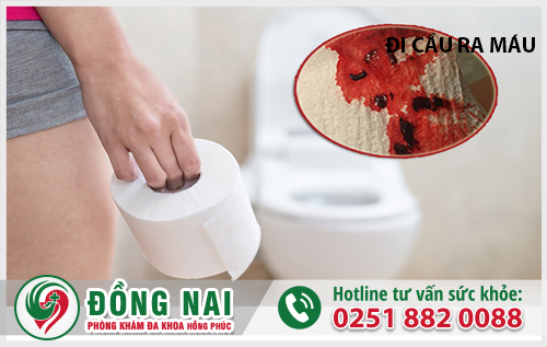 Đi cầu ra máu cách chữa hiệu quả hiện nay, chỉ có tại Biên Hòa Đồng Nai