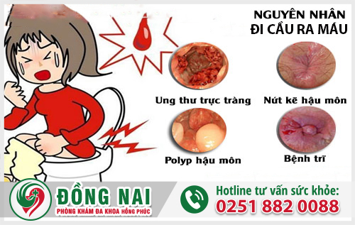 Khá nhiều bệnh lý dẫn đến hiện tượng đi cầu ra máu