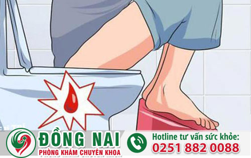 Cách Điều Trị Đi Cầu Ra Máu Từ Bác Sĩ Chuyên Môn