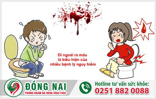 Đi ngoài ra máu tươi là dấu hiệu của các bệnh lý nguy hiểm