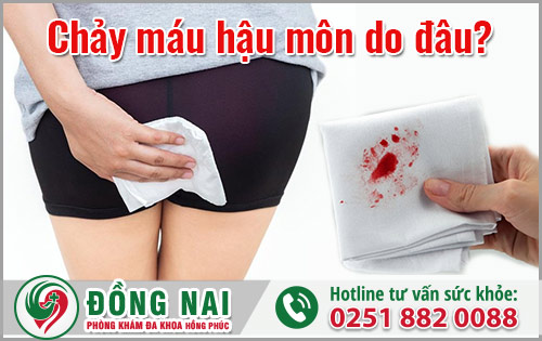 Chảy máu hậu môn là dấu hiệu của nhiều bệnh lý nguy hiểm
