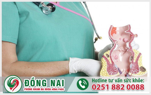 Chữa trị bệnh trĩ ở đâu tốt tại Biên Hòa