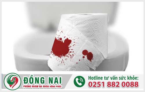 Chữa trị phân lẫn máu tại Biên Hòa