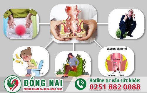 Những biến chứng nguy hiểm của bệnh trĩ gây ra
