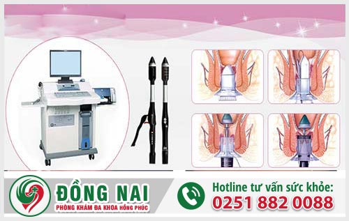 Cục thịt thừa ở hậu môn là bệnh gì? Có gây nguy hiểm gì không? Cách chữa và điều trị ra sao?