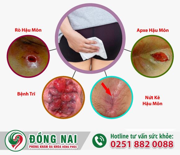 Đại tiện ra máu là do đâu? Có nguy hiểm không?