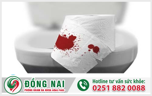 Đại tiện ra máu là do đâu? Có nguy hiểm không?