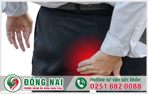 Triệu chứng bệnh trĩ là gì?