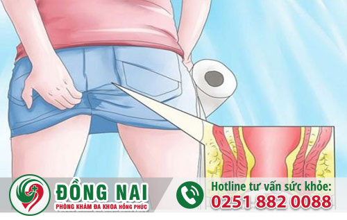 Dấu hiệu và nguy hại của bệnh trĩ