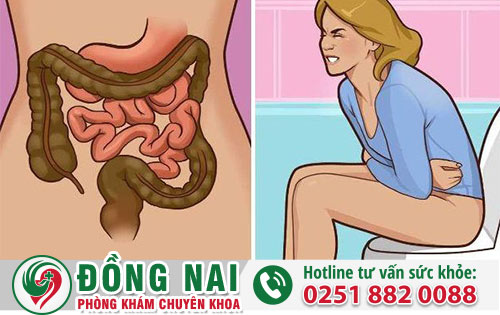 Dấu Hiệu Và Triệu Chứng Ung Thư Đại Tràng