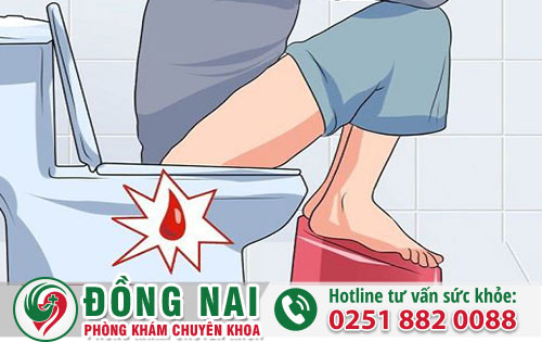 Đi cầu ra máu không ngừng cảnh báo những bệnh lý nguy hiểm nào?