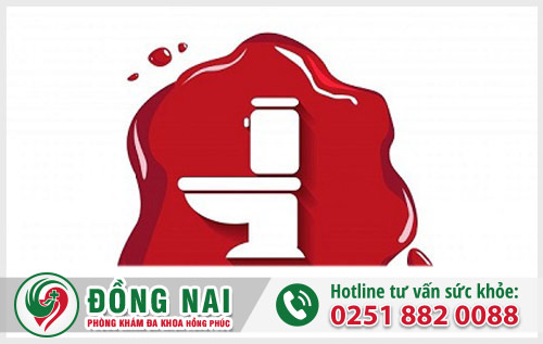 Đi cầu ra máu nhưng không đau là dấu hiệu bệnh gì?