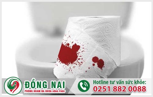 Đi cầu ra máu
