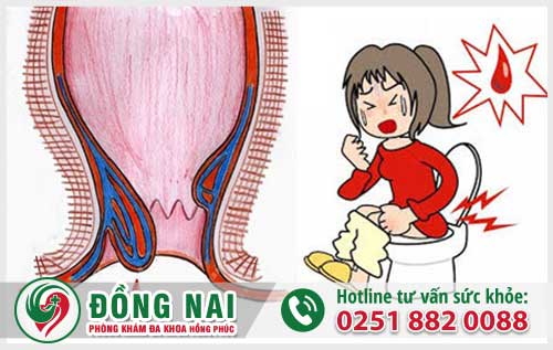Đi Đại Tiện Ra Máu Không Dứt Có Gây Nguy Hiểm Không?
