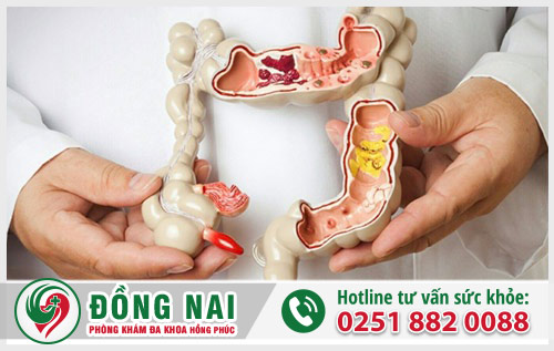 Đi ỉa ra máu là bệnh gì?