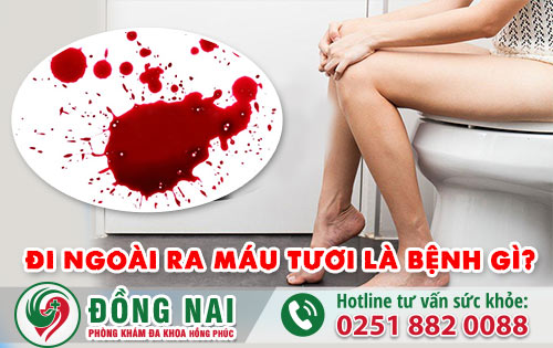 Đi ngoài ra máu tươi là dấu hiệu bệnh nguy hiểm cần chữa trị kịp thời