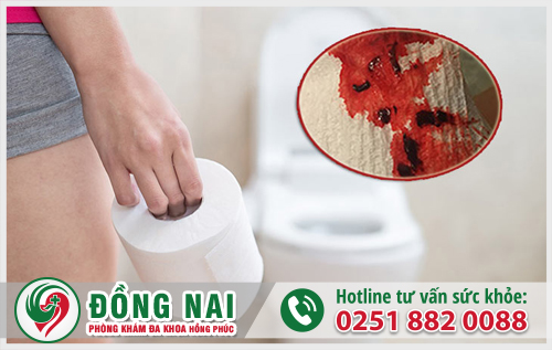 Đi vệ sinh ra máu gây ra nhiều biến chứng nguy hiểm cần điều trị sớm