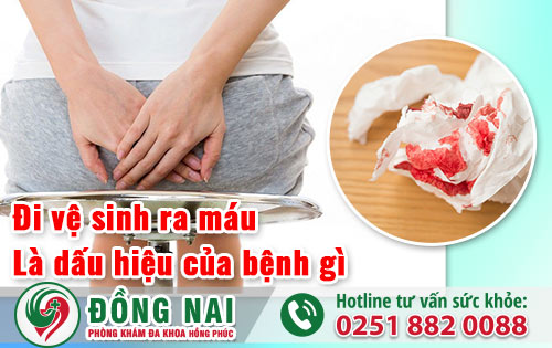 Đi vệ sinh ra máu là dấu hiệu của bệnh lý nào? Kéo dài không chữa ảnh hưởng như thế nào?