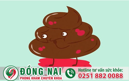 Đi vệ sinh ra máu là hiện tượng bất thường như thế nào?
