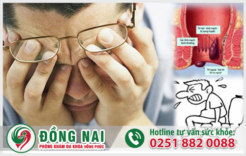 Bệnh trĩ nếu không được điều trị sớm sẽ gây ra nhiều biến chứng nguy hiểm