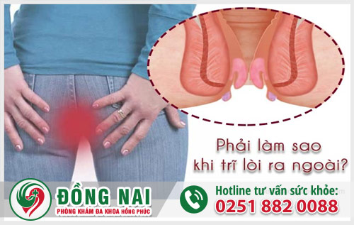 Điều trị sa búi trĩ chỉ sau một liệu trình