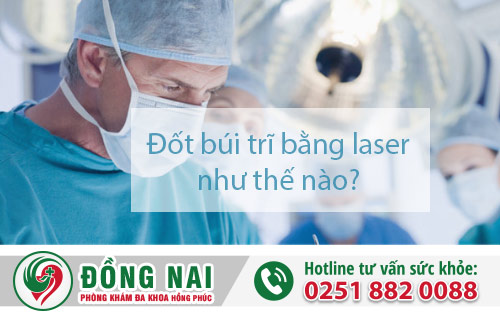 Đốt búi trĩ bằng laser như thế nào?