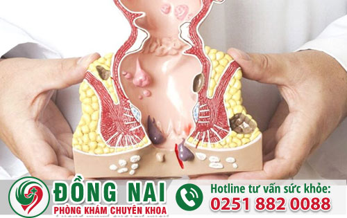 Hậu môn bị đau rát khó chịu thì nguyên nhân từ đâu?