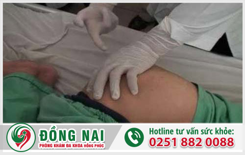 Hậu môn chảy mủ là bị bệnh gì?