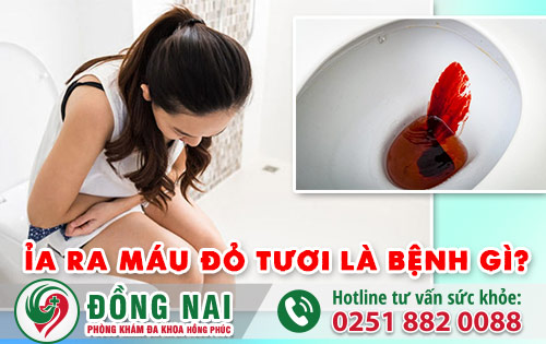 Ỉa ra máu đỏ tươi là bệnh gì? Là dấu hiệu của bệnh nào? Có nguy hiểm không?