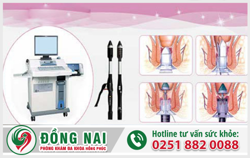 Khám bệnh trĩ ở đâu?