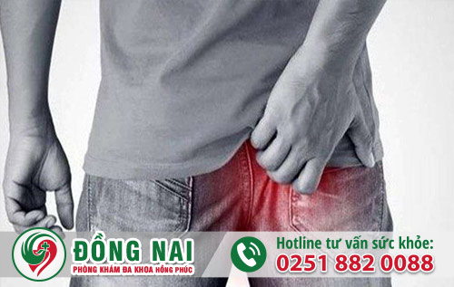 Khám hậu môn ở đâu tốt nhất tại Biên Hòa – Đồng Nai?