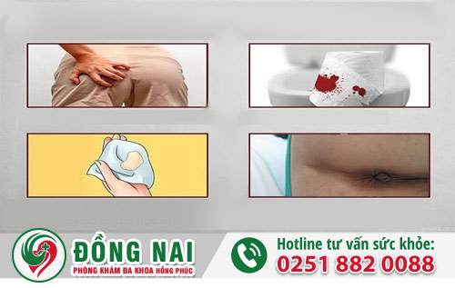 Cần đi khám hậu môn khi gặp các dấu hiệu này