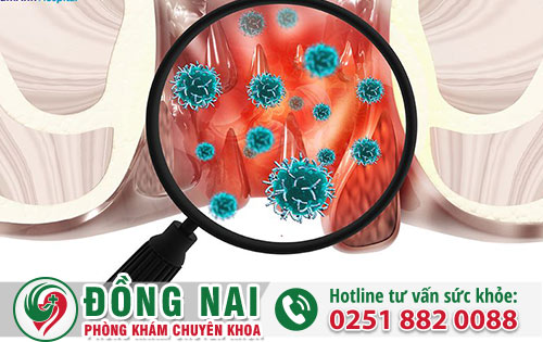 Ngứa Hậu Môn Là Biểu Hiện Của Bệnh Gì?