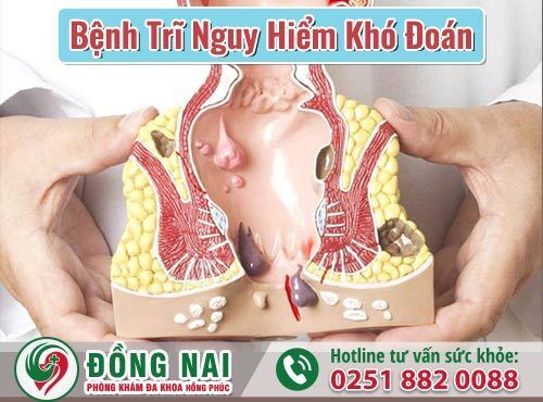 Bệnh trĩ nguy hiểm khó đoán