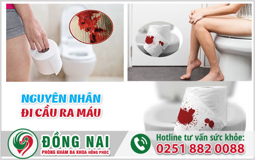 Nguyên nhân đi cầu ra máu tươi và cách điều trị như thế nào?