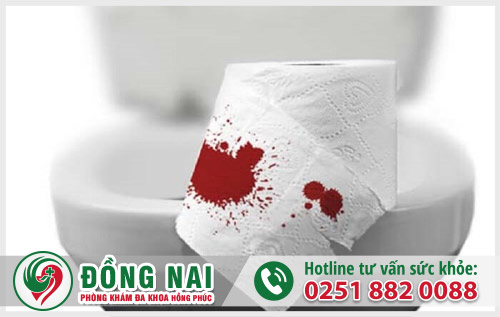 Nguyên nhân đi ngoài ra máu