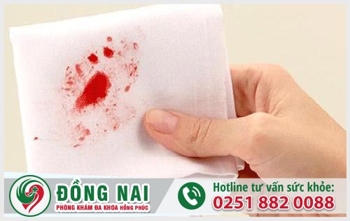 Nguyên nhân và cách chữa đi ngoài ra máu