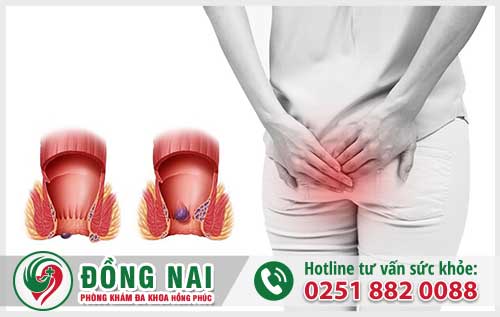Mỗ Trĩ Có Đau Không? Sau Mỗ Bao Lâu Thì Có Thể Về Nhà?
