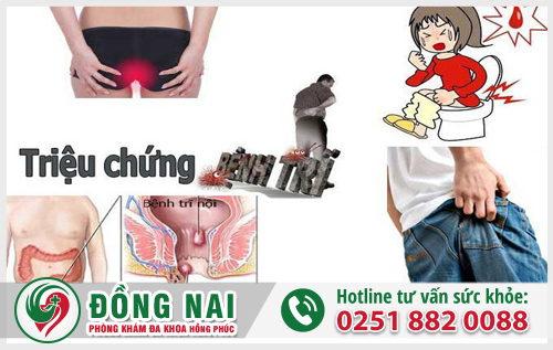 Phương pháp chữa bệnh trĩ tốt hơn chưa từng có hiện nay là gì?