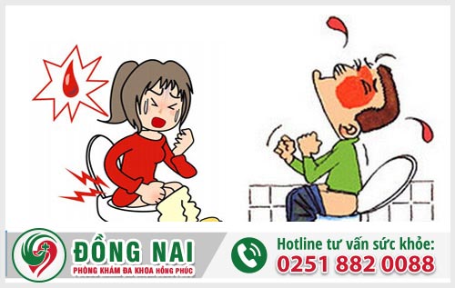 Phương pháp chữa trĩ hiệu quả và tiên tiến nhất hiện nay