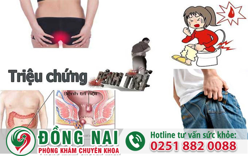 Bệnh trĩ gây ra hậu quả khôn lường cần được điều trị sớm