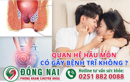 Quan Hệ Hậu Môn Có Gây Bệnh Trĩ Không