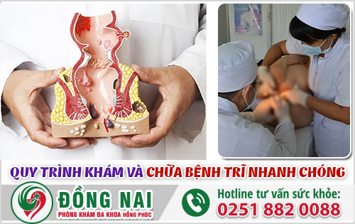 Quy trình khám và chữa bệnh trĩ nhanh chóng, hiệu quả